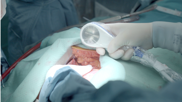 健康・医学 CARDIAC SURGERY 41s5cB8kvNL._AC_SY200_QL15_.jpg